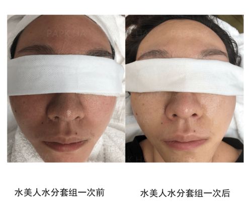 皮膚管理與生活美容 專業(yè)差異與生活服務